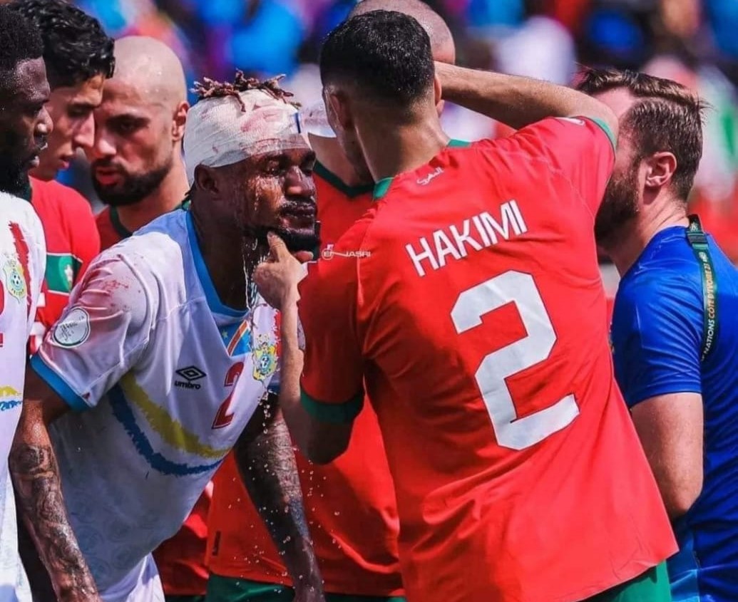 إنونغا يودع سيمبا قبل الانتقال للجيش الملكي